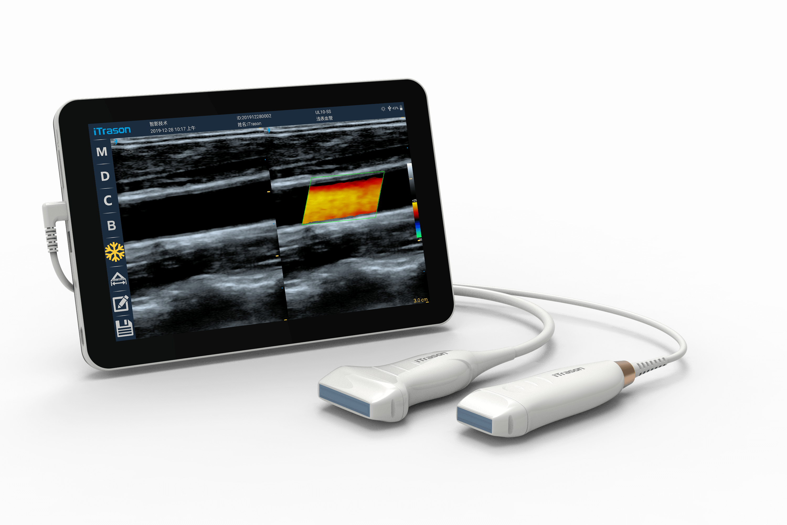 Vascular Access – Handheld POC Ultrasound System